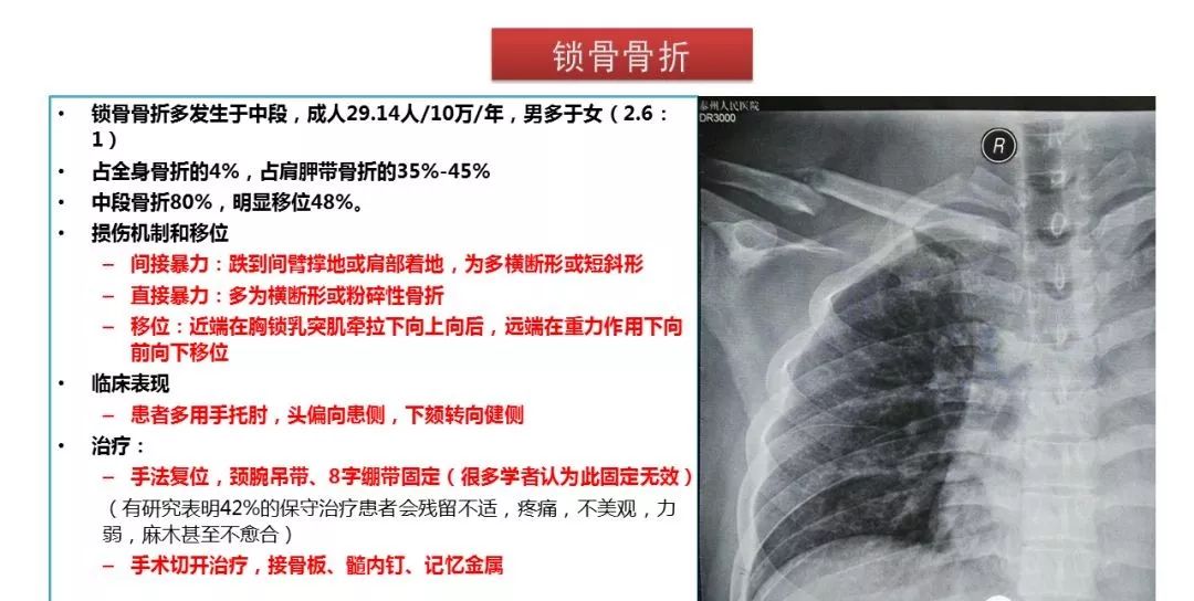 锁骨骨折康复之旅，探索自然美景的力量与希望